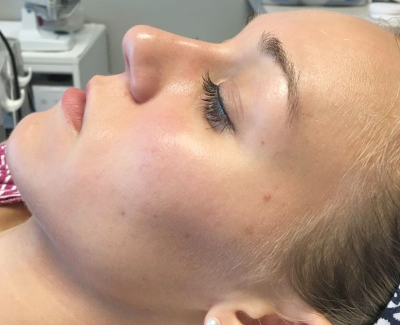 Westshore Skin & Health Center Before & After treatment photos