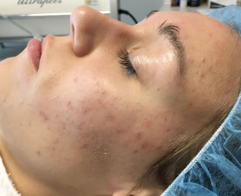 Westshore Skin & Health Center Before & After treatment photos