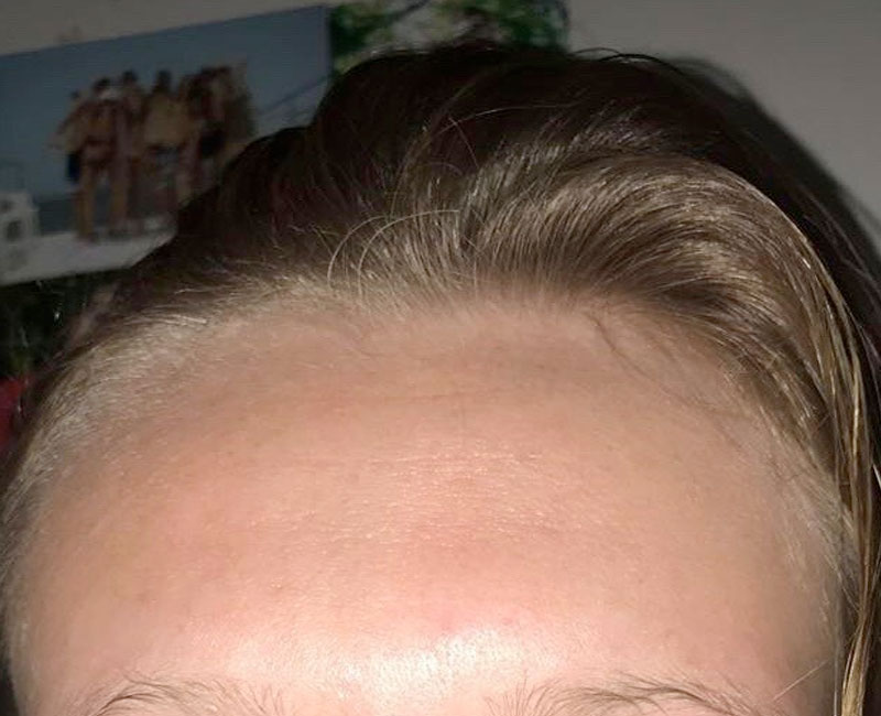 Westshore Skin & Health Center Before & After treatment photos