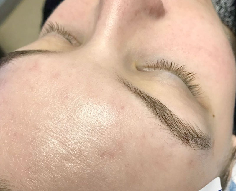 Westshore Skin & Health Center Before & After treatment photos